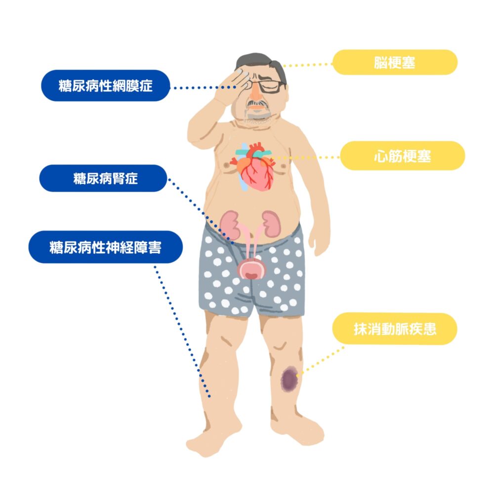 糖尿病が引き起こす合併症