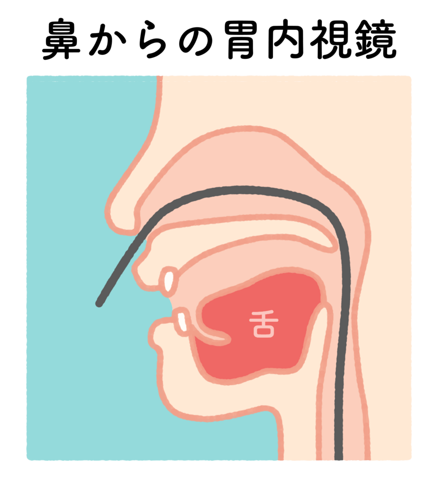 経鼻内視鏡検査
